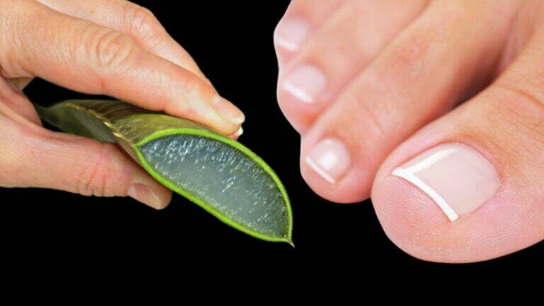 This simple solution reveals how to banish nail fungus using just four ingredients…