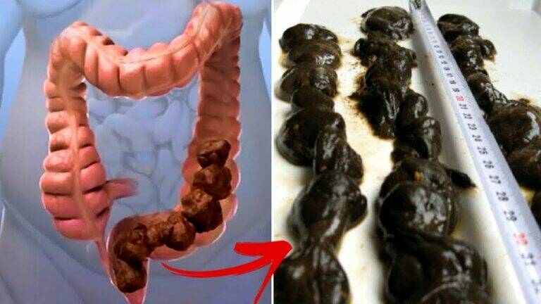 Discover this simple method to detox your colon and boost your well-being…