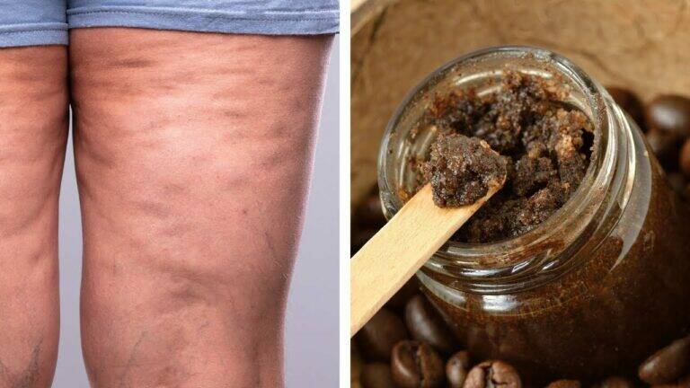 This simple coffee scrub transforms your skin, banishing cellulite and stretch marks…