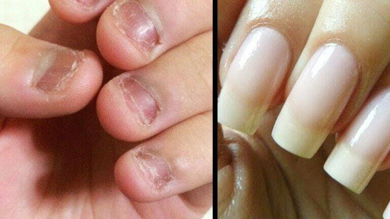 This simple remedy can transform your nails into stunning, strong beauty in days…