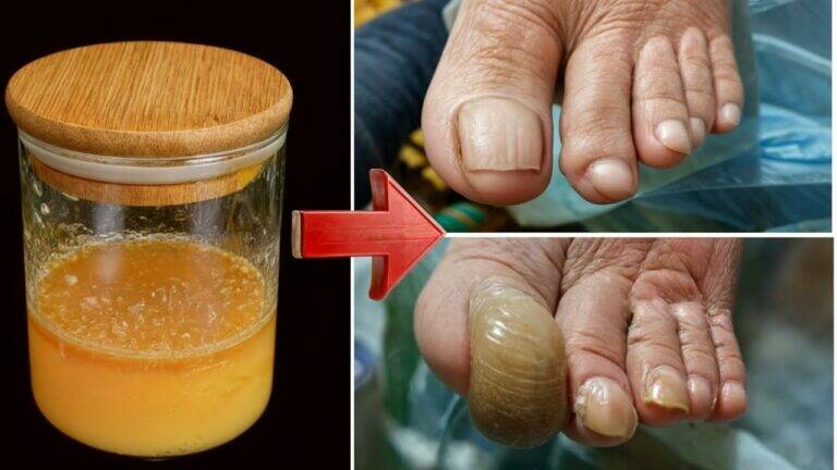 This simple remedy transforms your nails from damaged to healthy in no time…