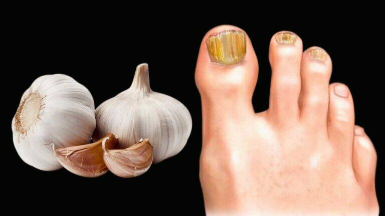 This simple remedy transforms nail health using garlic and everyday ingredients…