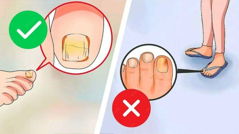 This simple trick transforms your nails from damaged to healthy in just days…