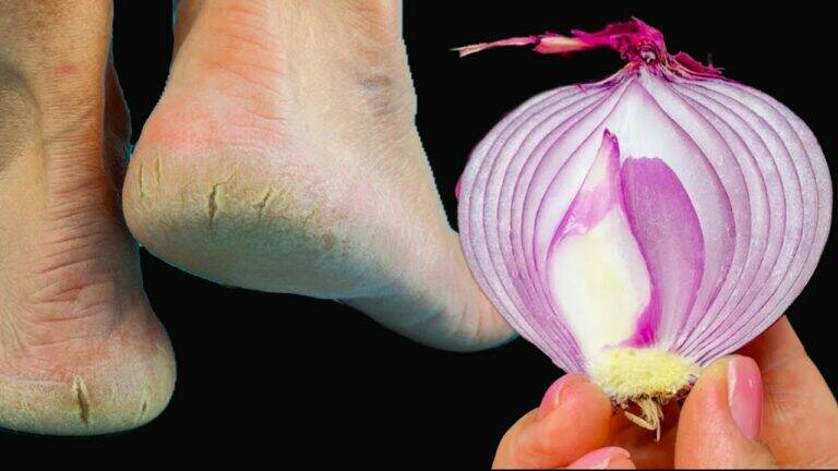 This forgotten trick transforms dry, cracked heels into soft, beautiful feet forever…