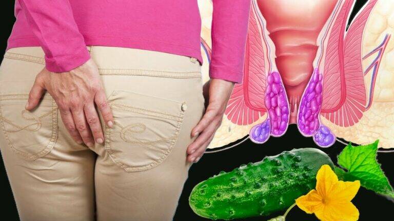 This simple remedy transforms swollen hemorrhoids into relief in just one day…