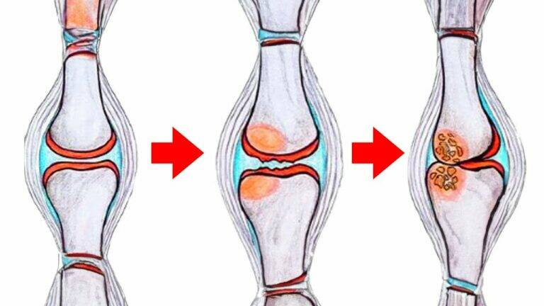This simple diet change can transform your joint health… discover the best foods today!