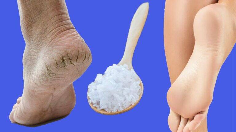This simple trick transforms cracked heels into soft, baby-like feet …