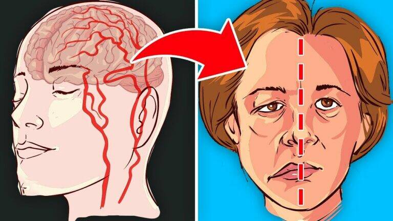 This simple food swap could dramatically lower your stroke risk…