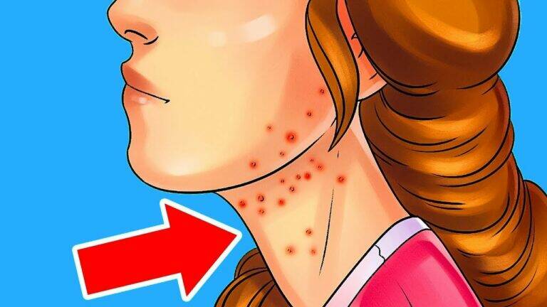 This common sign could mean diabetes is lurking… recognize it before it’s too late!