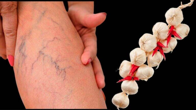 This simple garlic trick transforms nail fungus into healthy nails… discover how!