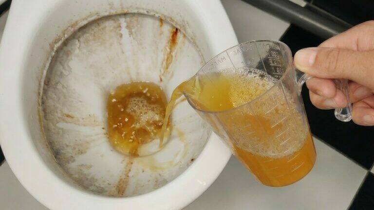 Zrób 1 prosty krok, żeby twój toilet stał się śnieżnobiały!