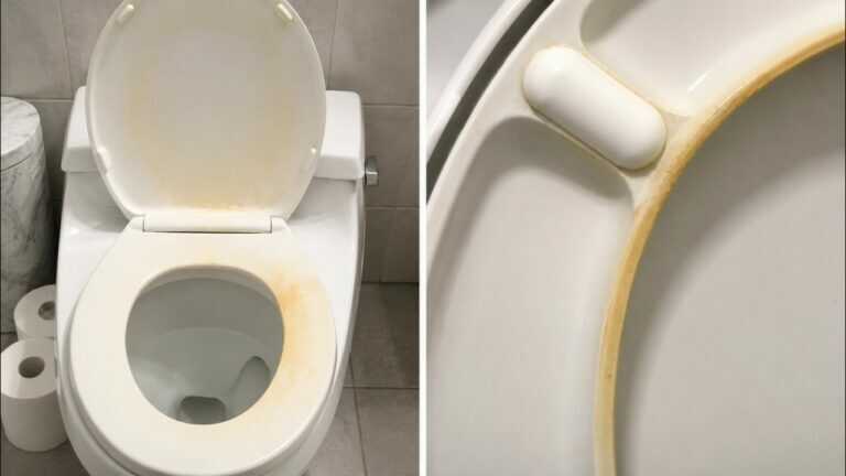 Gelbe Flecken auf dem WC-Sitz? Wisch sie einfach DAMIT ab! Sie verschwinden in Minuten
