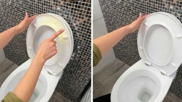 Gelbe Flecken auf der Toilettenbrille? Sie verschwinden ganz ohne Austausch
