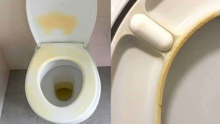 Saugt gelbe Flecken wie ein Schwamm auf. Wisch den Toilettensitz ab und vergiss das Problem
